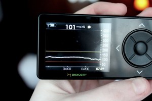 dexcom flatline